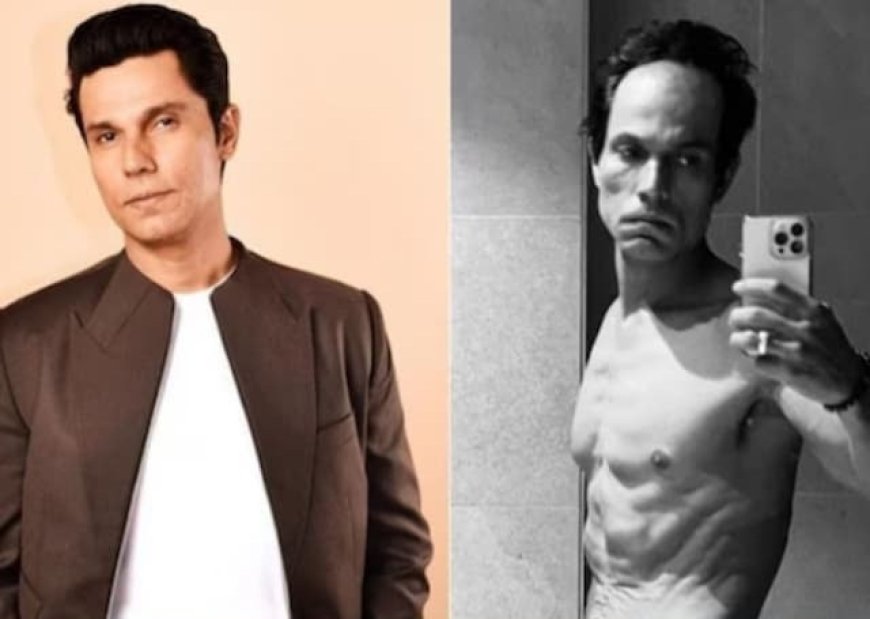 Randeep Hooda lost 32kgs for his movie 'Swatantra Veer Savarkar'